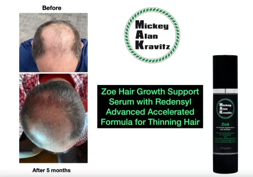 МАК Hair Продукти от Мики Alan Кравиц Серум за подпомагане на растежа на косата Зоуи с Реденсилом, подобряване на ускорена формула за изтъняване