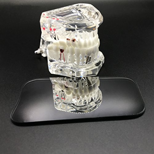 Omonic 5 бр./компл. 2-Едностранно Стоматологично Окклюзионное Фотографско Огледало За Устата, Стъкло С Родиевым Стоматологическим Покритие,